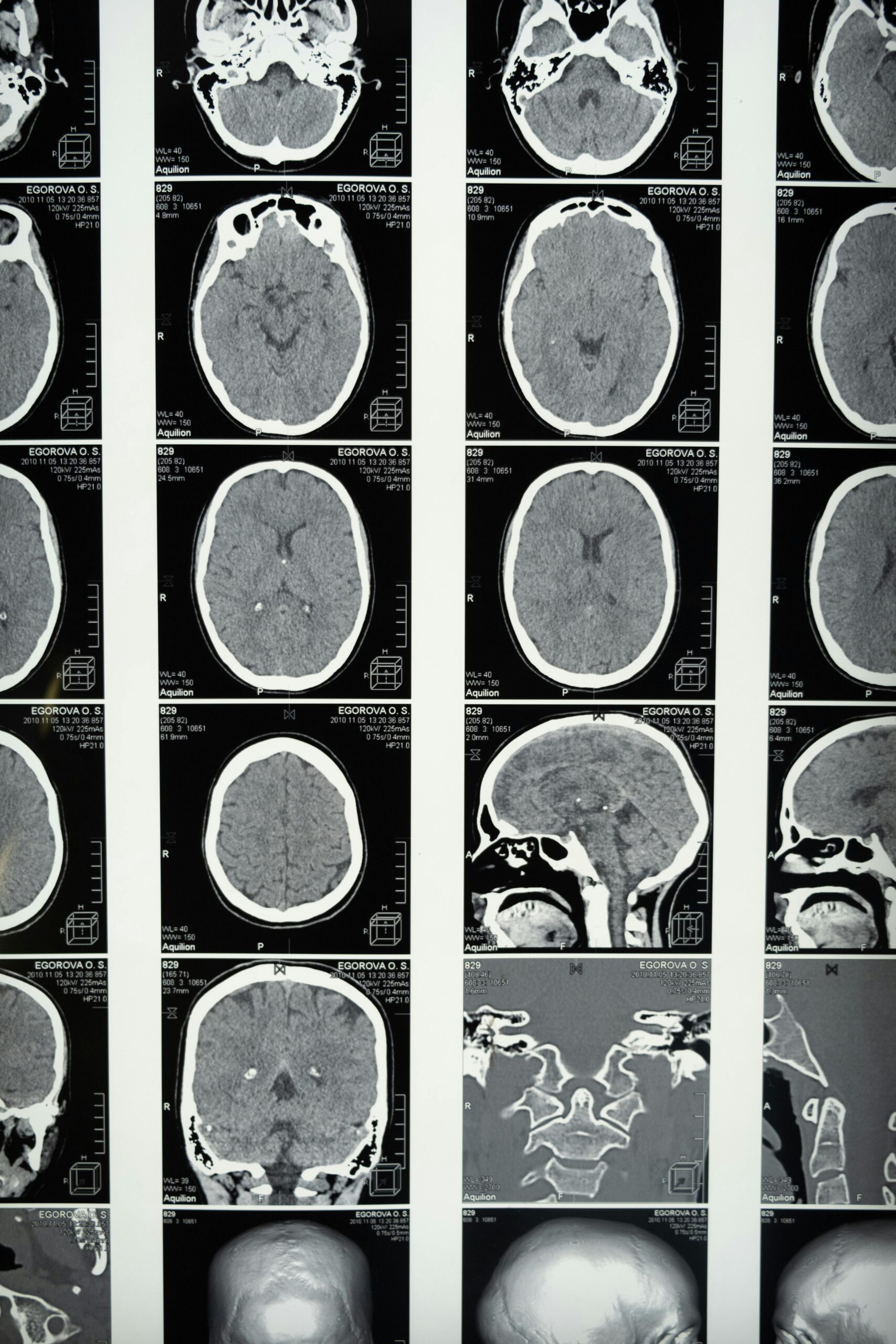 Neurodivergence EDM